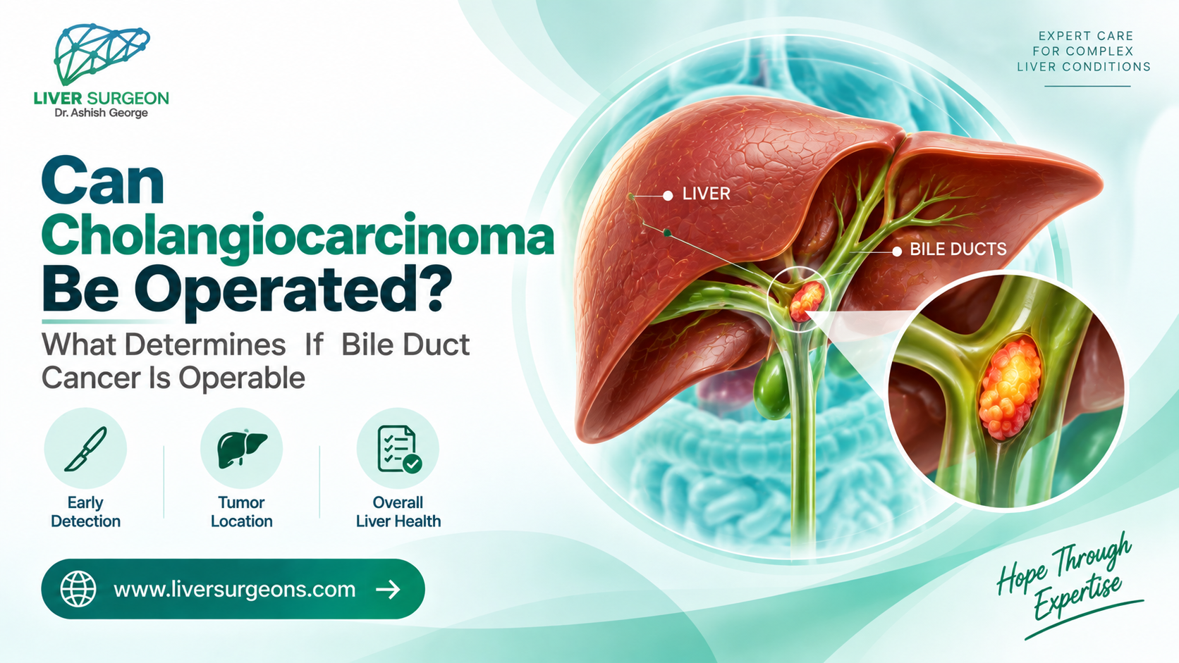 Can Cholangiocarcinoma Be Operated? Bile Duct Cancer Surgery