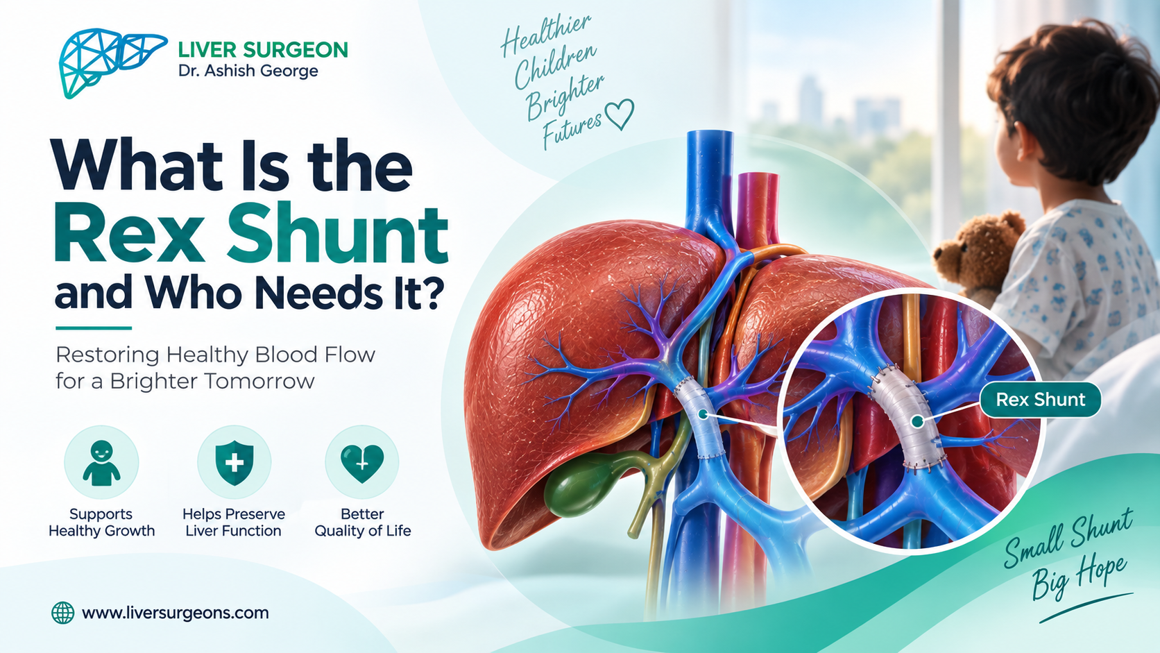 Rex shunt surgery for EHPVO in children, restoring blood flow to the liver