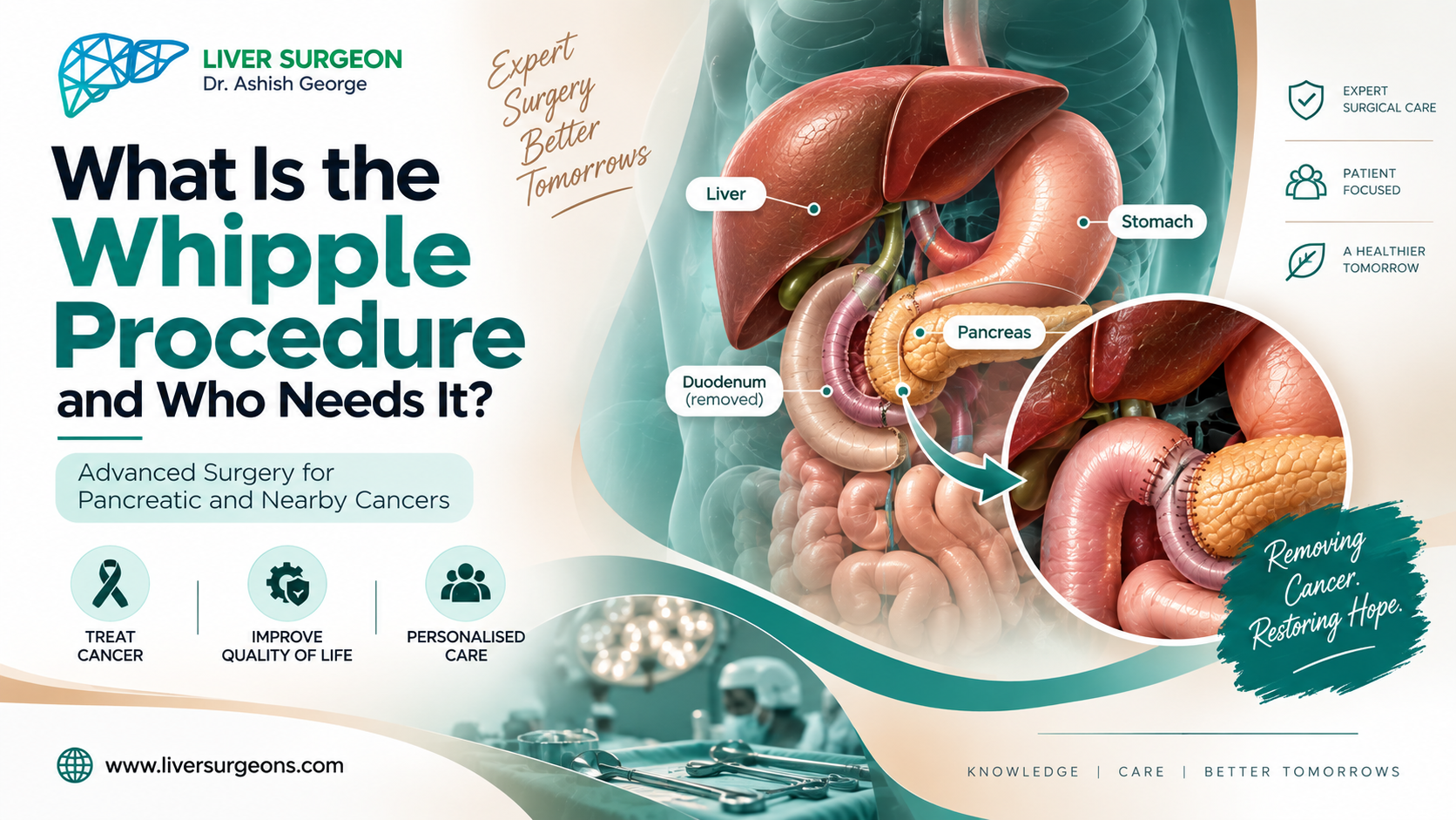 Whipple Procedure surgery for pancreatic cancer and periampullary tumors