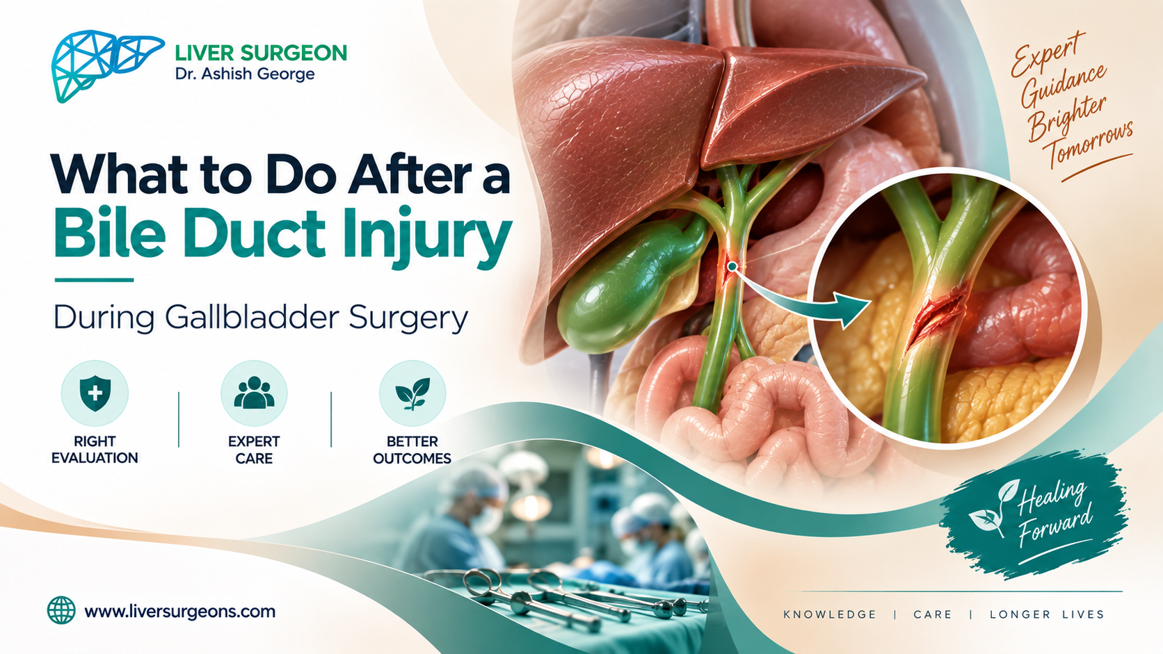 Bile duct injury after gallbladder surgery and repair by HPB surgeon